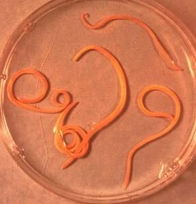 The parasites of the man are askaride