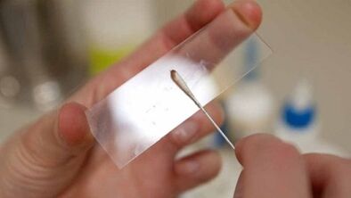 Calais analysis to determine the parasites