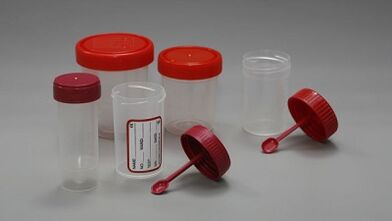 How to prepare for the test of parasites