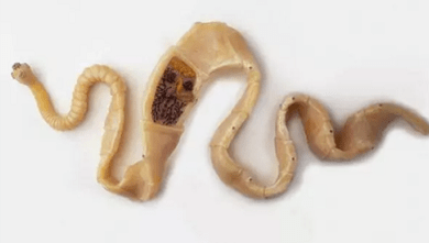 How to find the presence of parasites in the body