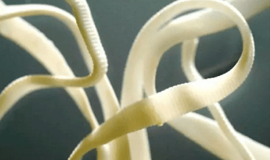 How to remove parasites from the human body